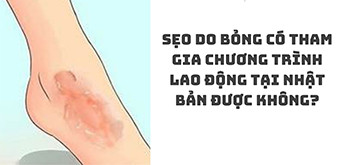 SẸO DO BỎNG CÓ THAM GIA CHƯƠNG TRÌNH LAO ĐỘNG NHẬT BẢN ĐƯỢC KHÔNG?
